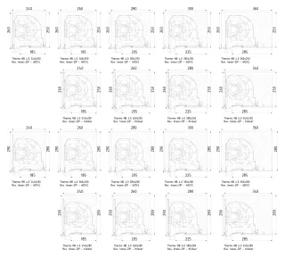 Thermo NB 4.0® Neubauaufsatzkasten für Rollläden, Raffstore und Tuchverschattung Thermo NB 4.0® Neubauaufsatzkasten für Rollläden, Raffstore und Tuchverschattung